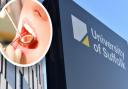 A new dental clinic is to be opened at University of Suffolk,