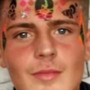 Harry Burkett, 21, died after being stabbed in Clacton last year