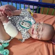 Baby Winnie-Rae is recovering well from her second major surgery. Image: Family of Winnie-Rae Southgate